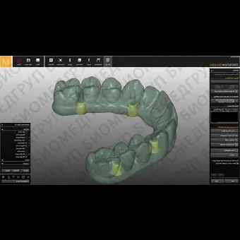Программное обеспечение для стоматологической имплантологии Occlusally Screwed Bridges