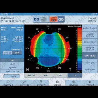 Роговичный топограф i.Profiler plus