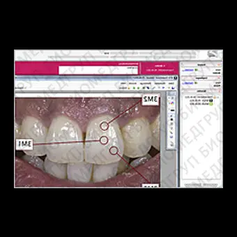 Программное обеспечение для стоматологических лабoраторий VITA ShadeAssist, VITA ToothConfigurator