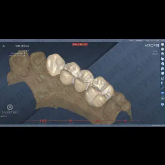 Программное обеспечение для лабораторий DentalCad