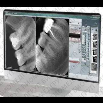 Программное обеспечение для обработки снимков зубов Quickvision
