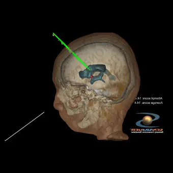 Медицинский симулятор для хирургии ImmersiveView Surgical Plan