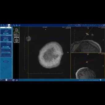 Программное обеспечение для медицинских снимков NeuroBlate  SoftwareTM NeuroBlate 