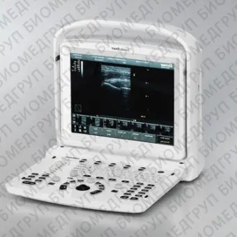 Переносной ультразвуковой сканер SonidoSmart