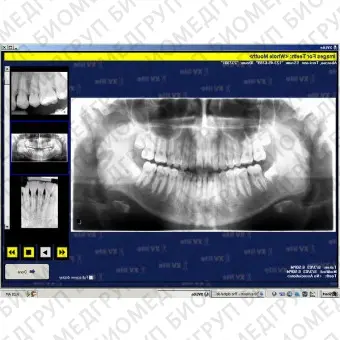 Программное обеспечение для обработки снимков зубов XrayVision