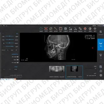 Программное обеспечение для обработки снимков зубов SmartV Pro