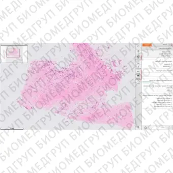 Программное обеспечение для лаборатории гистопатологии Xplore