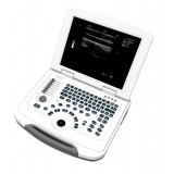 Переносной ультразвуковой сканер HF-500