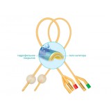Катетер Фолея двухходовой педиатрический с гидрофильным покрытием, Ch/Fr 10, объем баллона 3-5 мл   Mederen