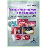 Регенеративные методы в имплантологии / Ф. Кури